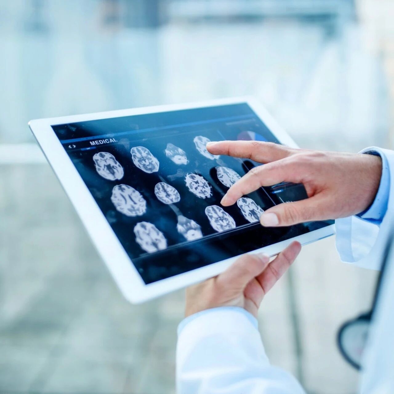 5 Ways Robotics Is Transforming Healthcare