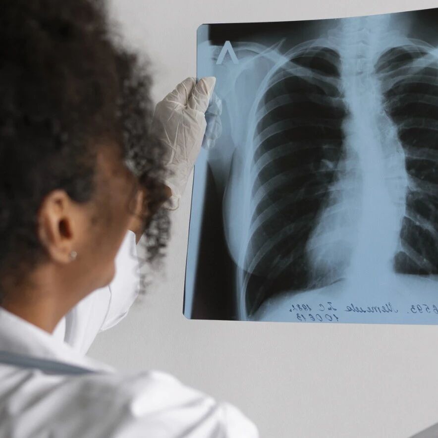 Lung cancer claims more than 1.8 million lives each year, but early detection using AI can improve treatment outcomes.