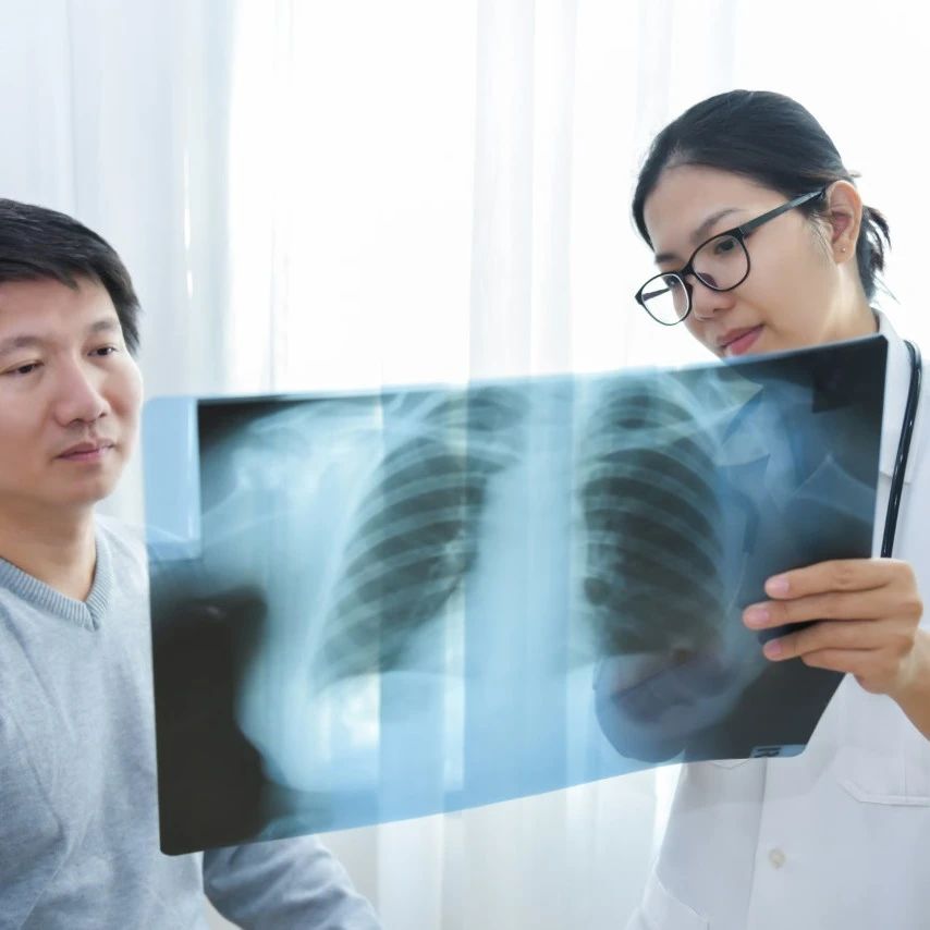 AI-powered screening makes early lung cancer detection more accessible, helping to save 1.8 million lives.